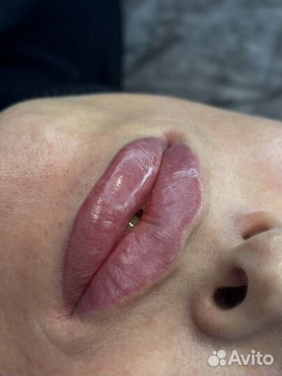 Косметолог губы ботокс