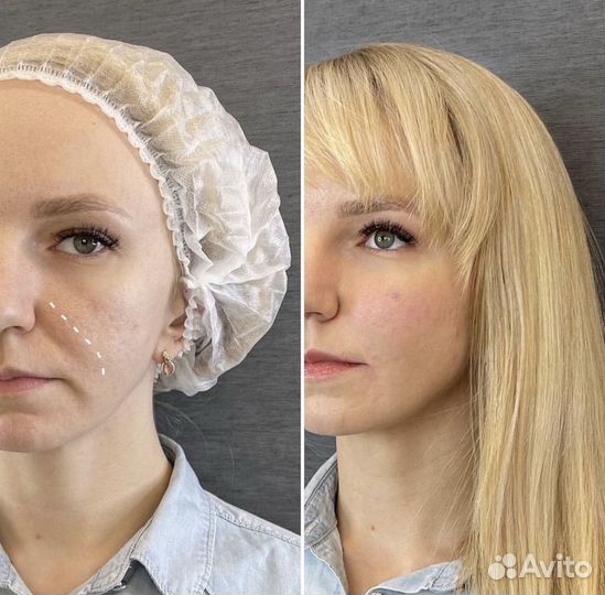 Скульптурный массаж лица