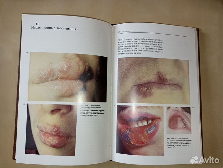 Атлас заболеваний слизистой оболочки полости рта