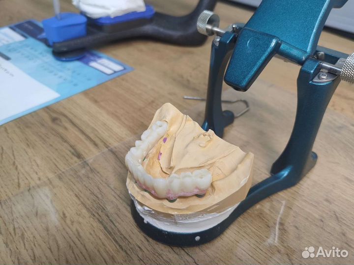 Зубной техник, керамист