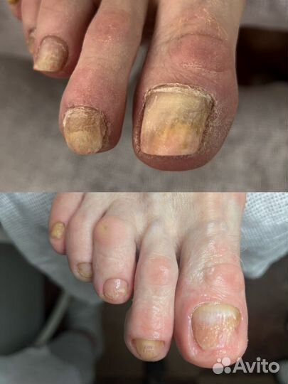 Мужской.Женский.Педикюр.Подолог