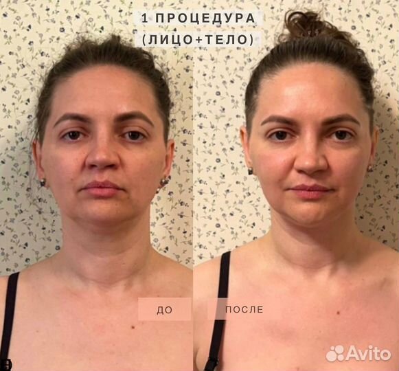 Глубокотканный массаж лица.Массаж тела