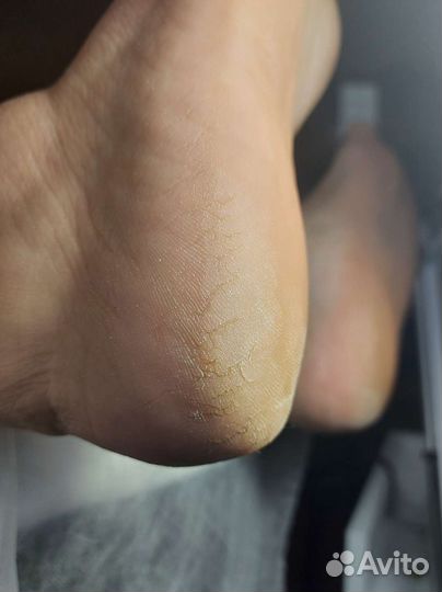 Смарт педикюр, маникюр