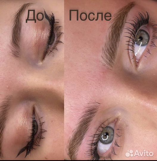 Микроблейдинг 6 Д