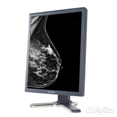 Монитор врача рентгенолога