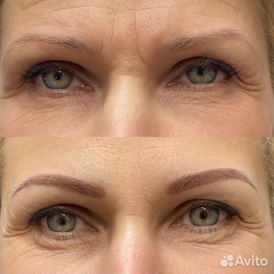 Приглашаем моделей Удаление татуажа/пм