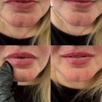 Косметология. Full Face, Софрино