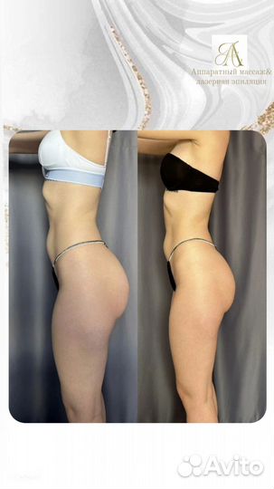 Аппаратный массаж