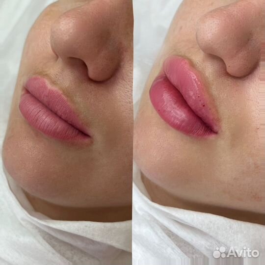 Услуги косметолога