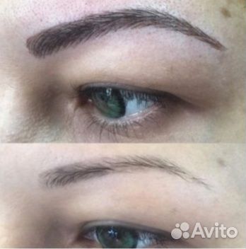 Удаление татуажа ремувером. Пудровое напыление губ