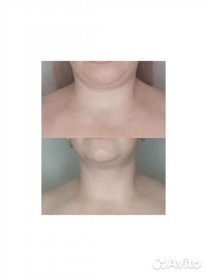 Коррекция фигуры и массаж