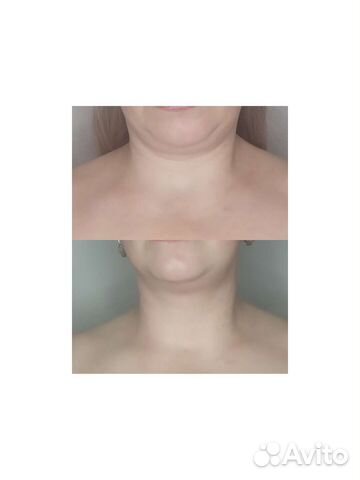 Коррекция фигуры и массаж