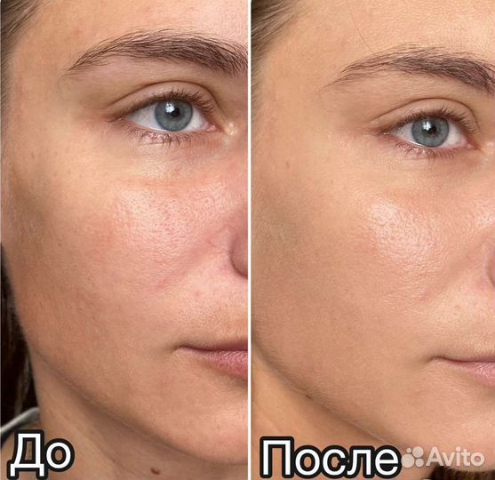 Кушон-крем zozu