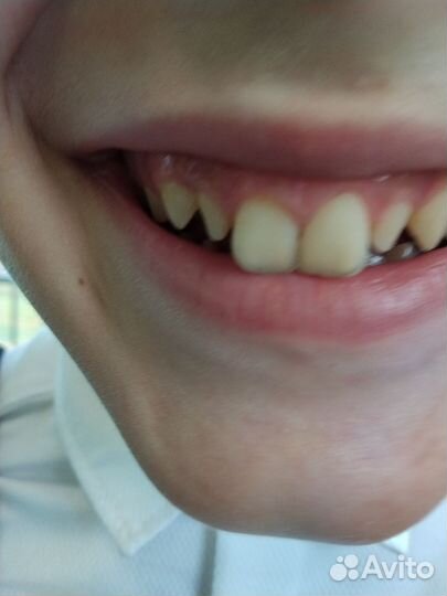 Зуб Сталина