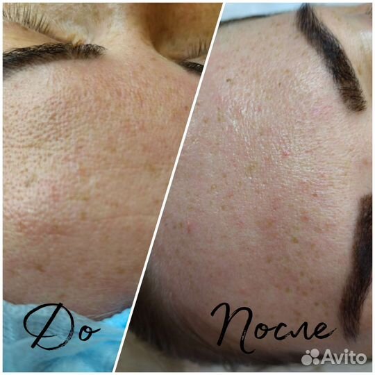 Массаж лица и косметология