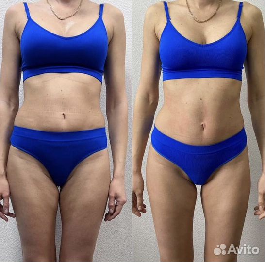 Аппаратный массаж/Антицеллюлитный массаж