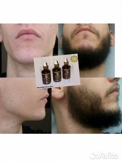 Миноксидил 25 для роста волос и бороды