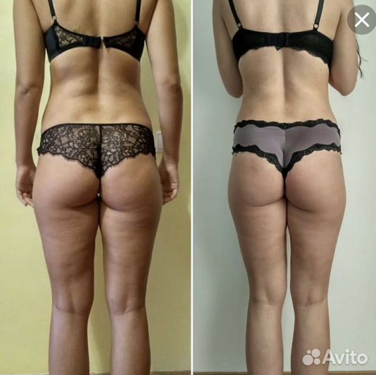 Армопластика