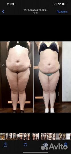 Аппаратный массаж