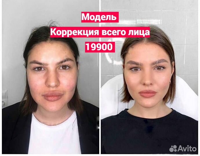 Full face