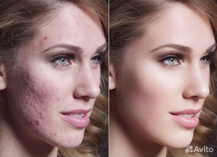 Обработка фотографий ретушь (от фотосессии)