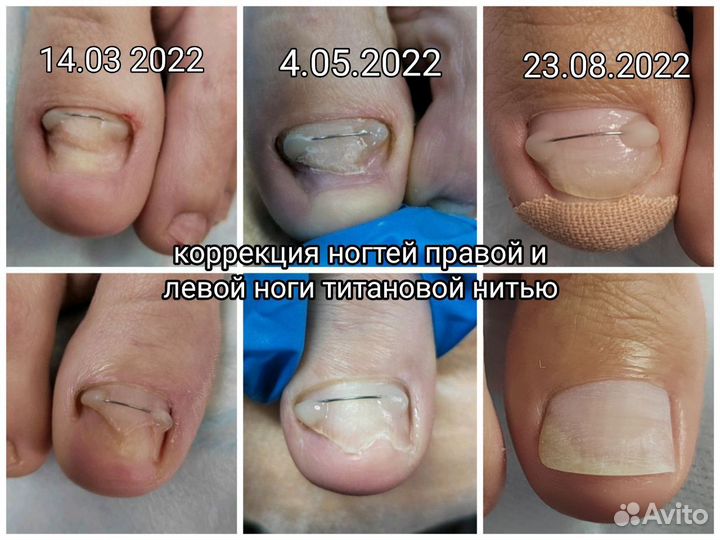 Подология