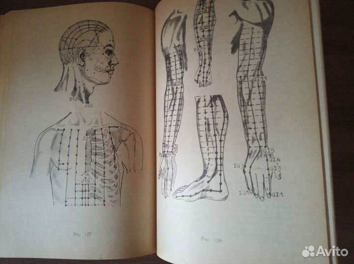 Иглорефлексотерапия.Справочник-атлас