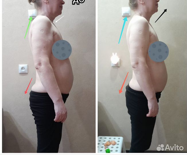 Остеопатия, телесные практики