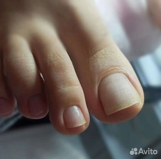 Сегодня есть окошки Педикюр на реклайнере