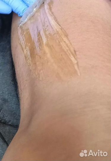 Шугаринг депиляция 8 кв