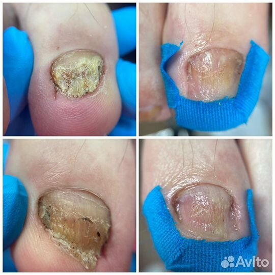 Подолог, мастер педикюра