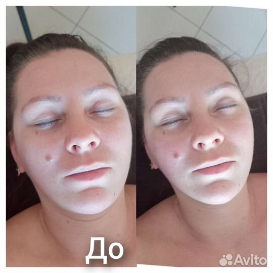 Массаж лица миофасциальный