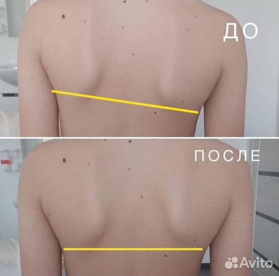 Костоправ