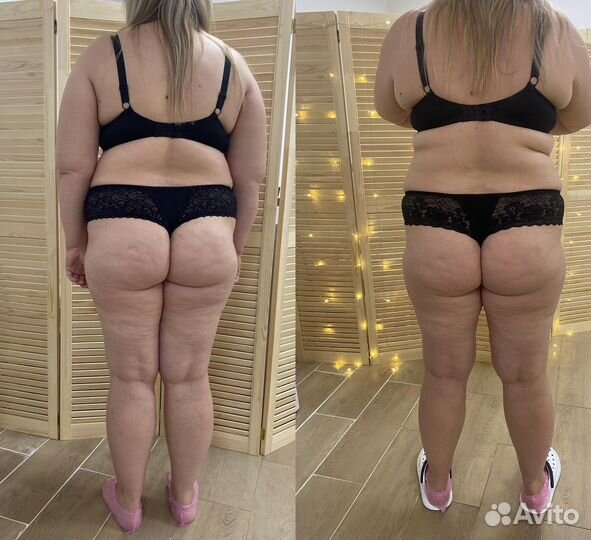 Lpg массаж тела и лица,жиротоп Microwave