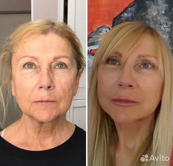 Услуги косметолога