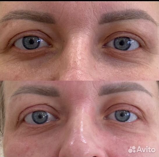 Холодная плазма