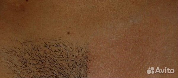 Шугаринг,педикюр,Выезд на дом