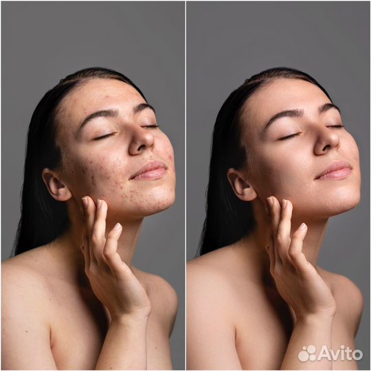 Профессиональная ретушь и обработка фотографий