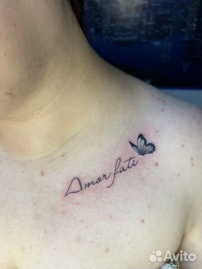 Тату,Пирсинг. Удаления