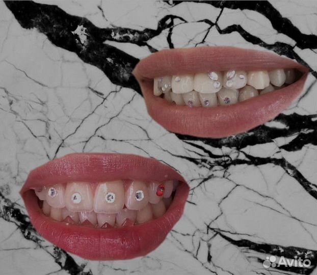 Установка скайсов