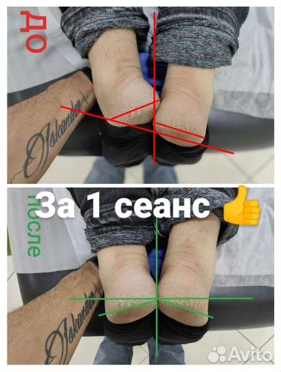 Костоправ, Мануальный массаж, Массажист