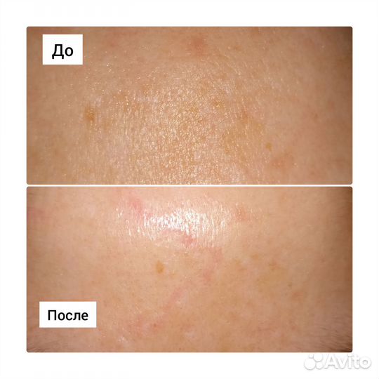 Пептидная и лечебная косметика