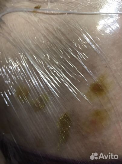 Мазь от псориаза