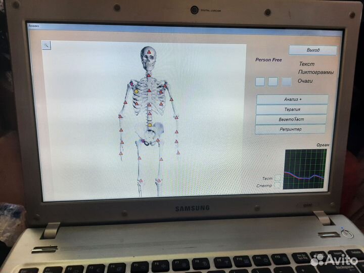 Диагностический аппарат брт биотест метатрон