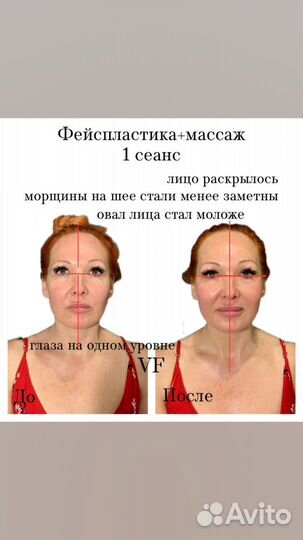 Массаж/ Фейспластика