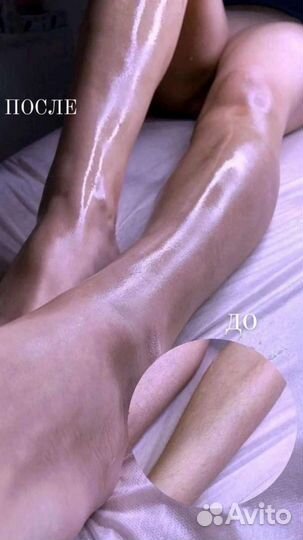 Шугаринг, косметолог