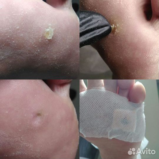 Мастер педикюра, Подолог