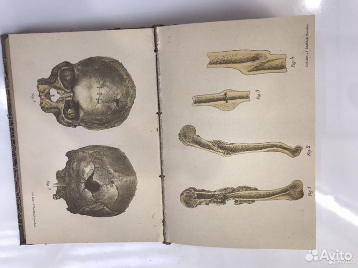 Медицинский атлас 1895 года