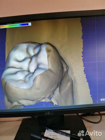 Зубной Техник, Съёмные протезы, Виниры, Керамика