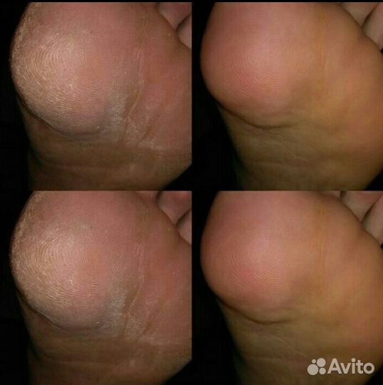 Маникюр, педикюр